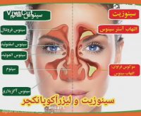 ضرورت درمان سینوزیت مزمن