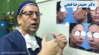 جراحی بینی و چانه