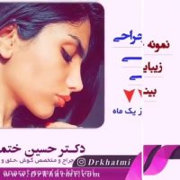 نمونه جراحی بینی دکتر حسن ختمی