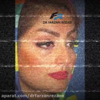 فیلم سه ماه بعد از جراحی بینی