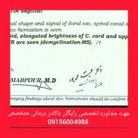 علائم بیماری ام اس در بدن چیست؟