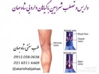 دارو گیاهی کرج -09120580638