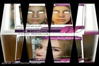 نمونه کار جراحی بینی