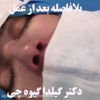 نمونه کار جراحی بینی دکتر گیلدا گیوهچی