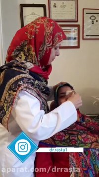 برداشتن گچ بینی