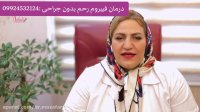 فیبروم رحم چیست و چگونه درمان می‌شود