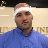 کاشت مو کلینیک رنسانس