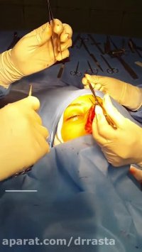 جراحی زیبایی بینی در اتاق عمل