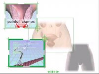 قاعدگی همراه با درد کمر درد و عضلات