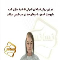 کلینیک رنسانس- ترمیم مو با تکنیک HRT