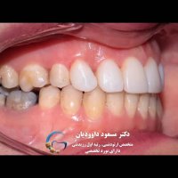دکتر ارتودنسی | دکتر داوودیان