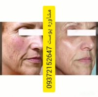 خواص کرم درمانی لازان (ضدچین و چروک جوانسازی پوست)