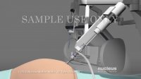 Robotic Bariatric Surgery | Nucleus Health