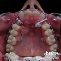 ارتودنسی دندان زیبایی