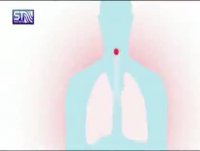 درست لحظه ای که ویروس کرونا وارد بدن می شود چه اتفاقی برای ما می افتد؟