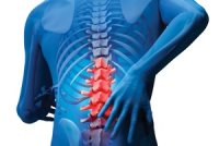 راه های پیشگیری از کمردرد