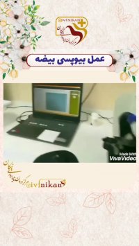 عمل بیوپسی بیضه توسط دکتر ناصر امیر جنتی