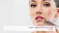 علل و درمان آکنه و جوش صورت