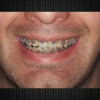 ارتودنسی غرب تهران | دکتر داوودیان