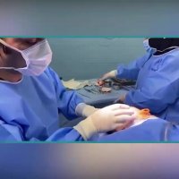 فیلم عمل لیفت صورت