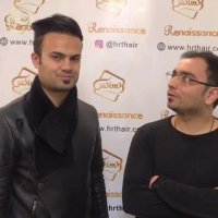 کاشت مو به روشSUT -کلینیک تخصصی رنسانس