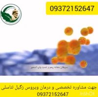 زگیل تناسلی درمان دارد ؟؟؟