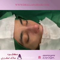 فیلم جراحی بینی طبیعی