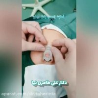 فیلم نحوه صحیح چسب زدن به بینی