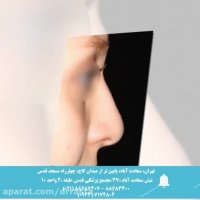 نمونه عمل بینی زنانه
