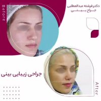 فیلم واقعی عمل بینی نیمه فاننتزی