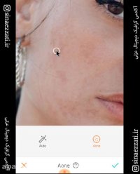 حذف جوش از عکس در اندروید و ios