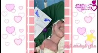 فیلم زایمان سزارین دکتر فرح ابطحی