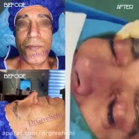 فیلم عمل زیبایی بینی