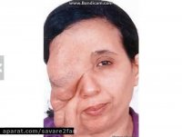 زن جوان عجیب الخلقه با قیافه ای بسیار ترسناک!