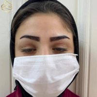 کاشت ابرو تخصصی