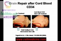 کلینیک تخصصی کاردرمانی در البرز گفتار توان گستر 09121623463