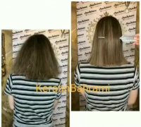 اوزون تراپی