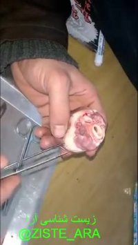 تشریح قلب بررسی ساختار بیرونی قلب و رگ ها