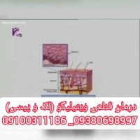 قطعی ترین درمان ویتیلیگو و پیسی
