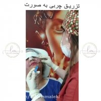 جوانسازی صورت با تزریق چربی به روش نانوفت