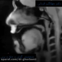 ام آر آی در حال صحبت