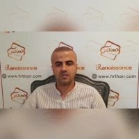 کاشت مو به روش انحصاری sutدر کلینیک تخصصی رنسانس