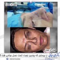 جراحی ترمیمی بینی