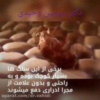 انواع سنگ کلیه