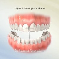 ارتودنسی شمال تهران | متخصص ارتودنسی