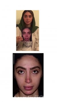 عمل زیبایی بینی