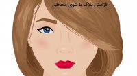 جراحی های لب به چه صورت انجام داده میشوند؟ | دکتر اکبر بیات