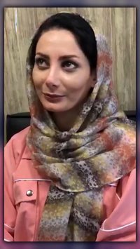 رضایت بیمار دو ماه بعد از جراحی زیبایی بینی