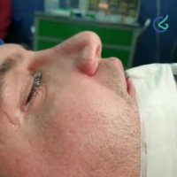 فیلم عمل بینی مردانه