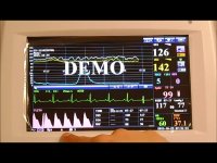 مشخصات دستگاه فتال مانیتورینگ ادان